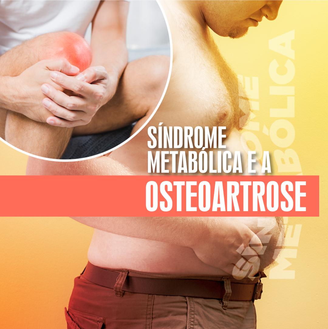 sindrome-metabolica-e-a-osteoartrose